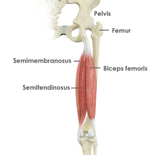 Hamstring Tendon Repair