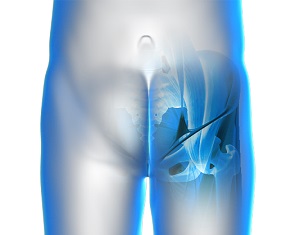 Hip Bursitis - Ortho Illinois